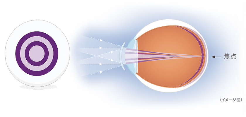 MiSight（マイサイト）の仕組み